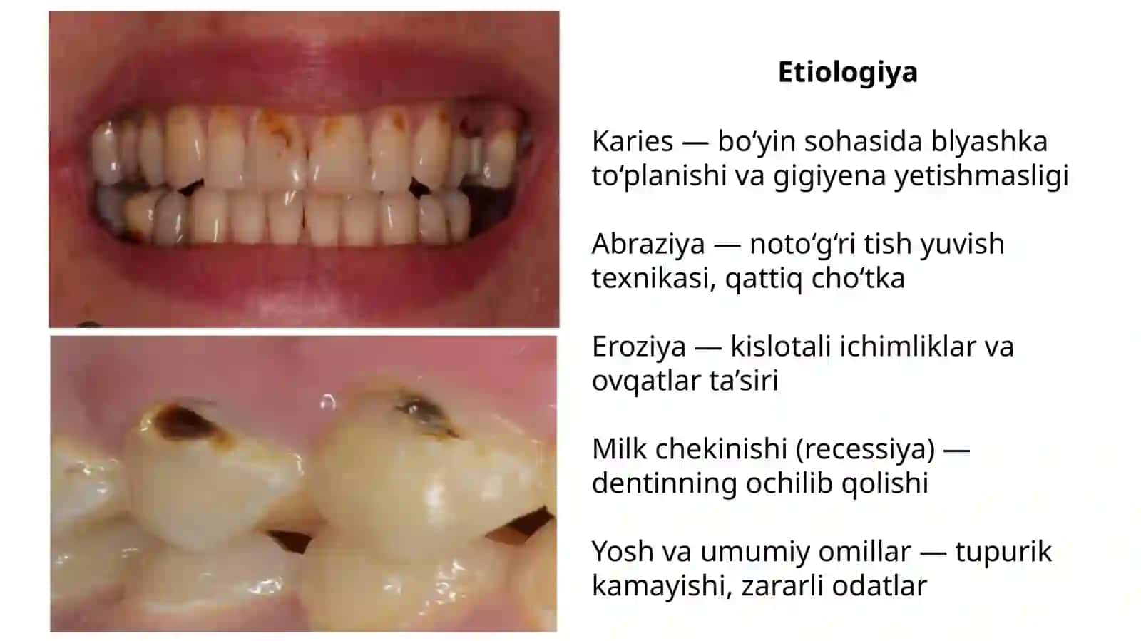 5-sinf kovaklarining asosiy xususiyatlari 4