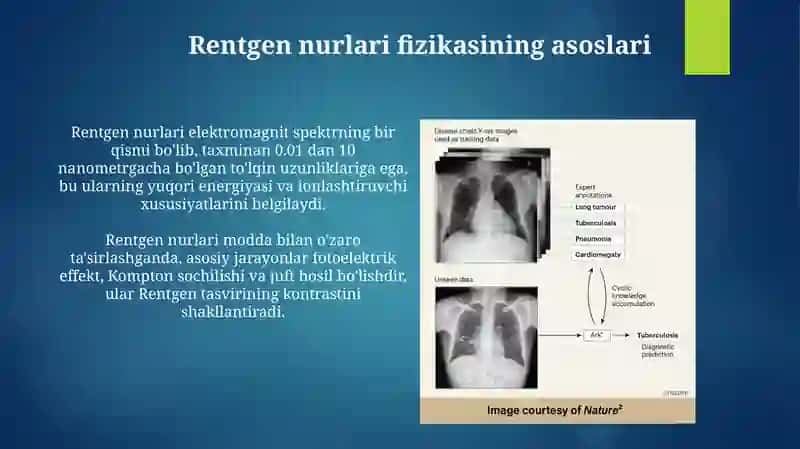 Rentgen nurlari 4