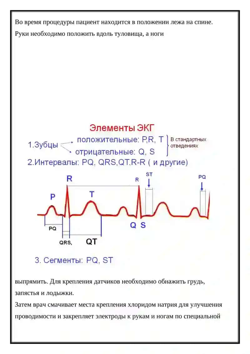 Электрокардиограмма 4