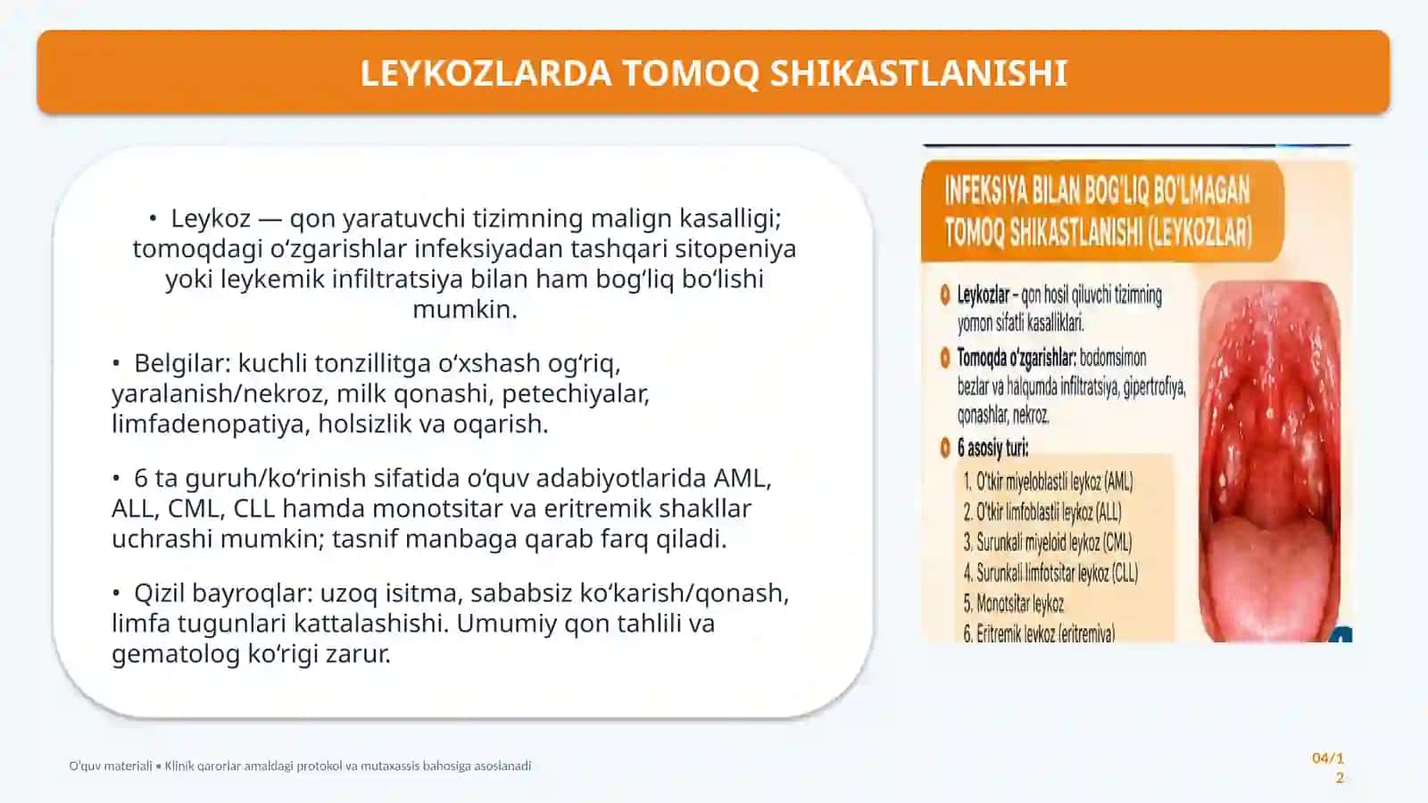 HAR XIL ETIOLOGIYALIANGINALAR VA BOSHQAKASALLIKLAR 4