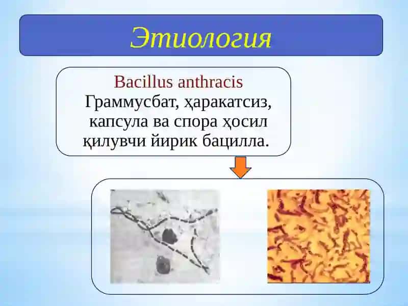Куйдирги (Anthrax) 4
