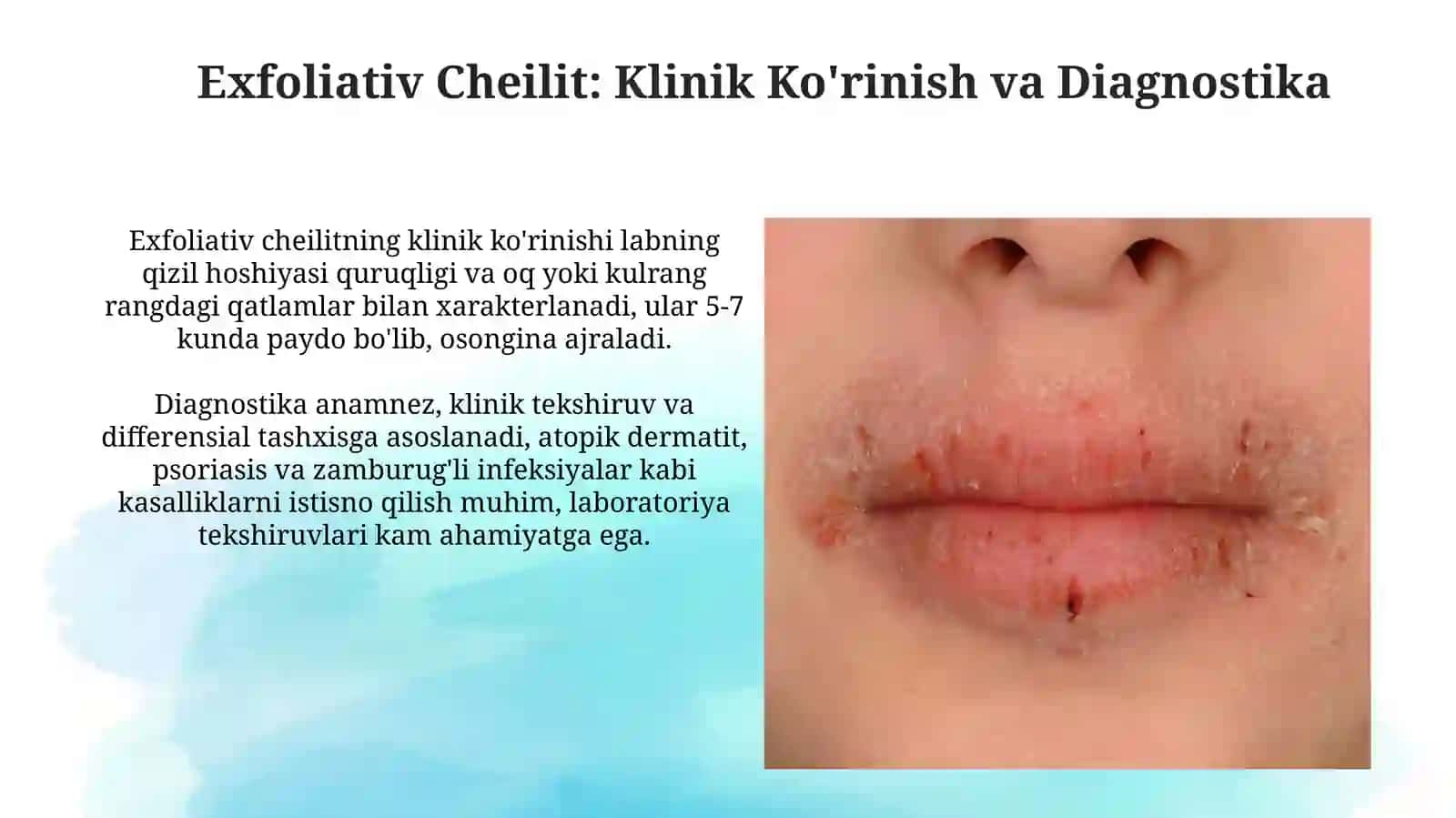 Xeylitlar. Eksfoliativ, aktinik, meteorologik, glandulyar 4