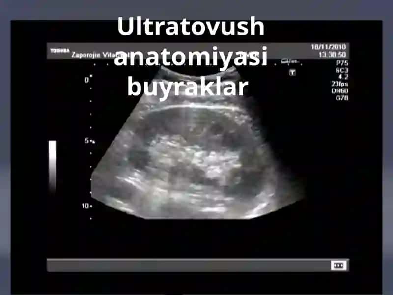 SIYDIK AJRATUVCHI YO'LLAR VA JINSIY AZOLAR KASALLIKLAR NUR TASHXISI 4