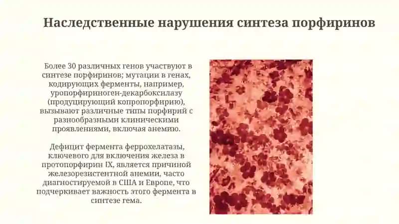 Генетические анемии и механизмы развития 4