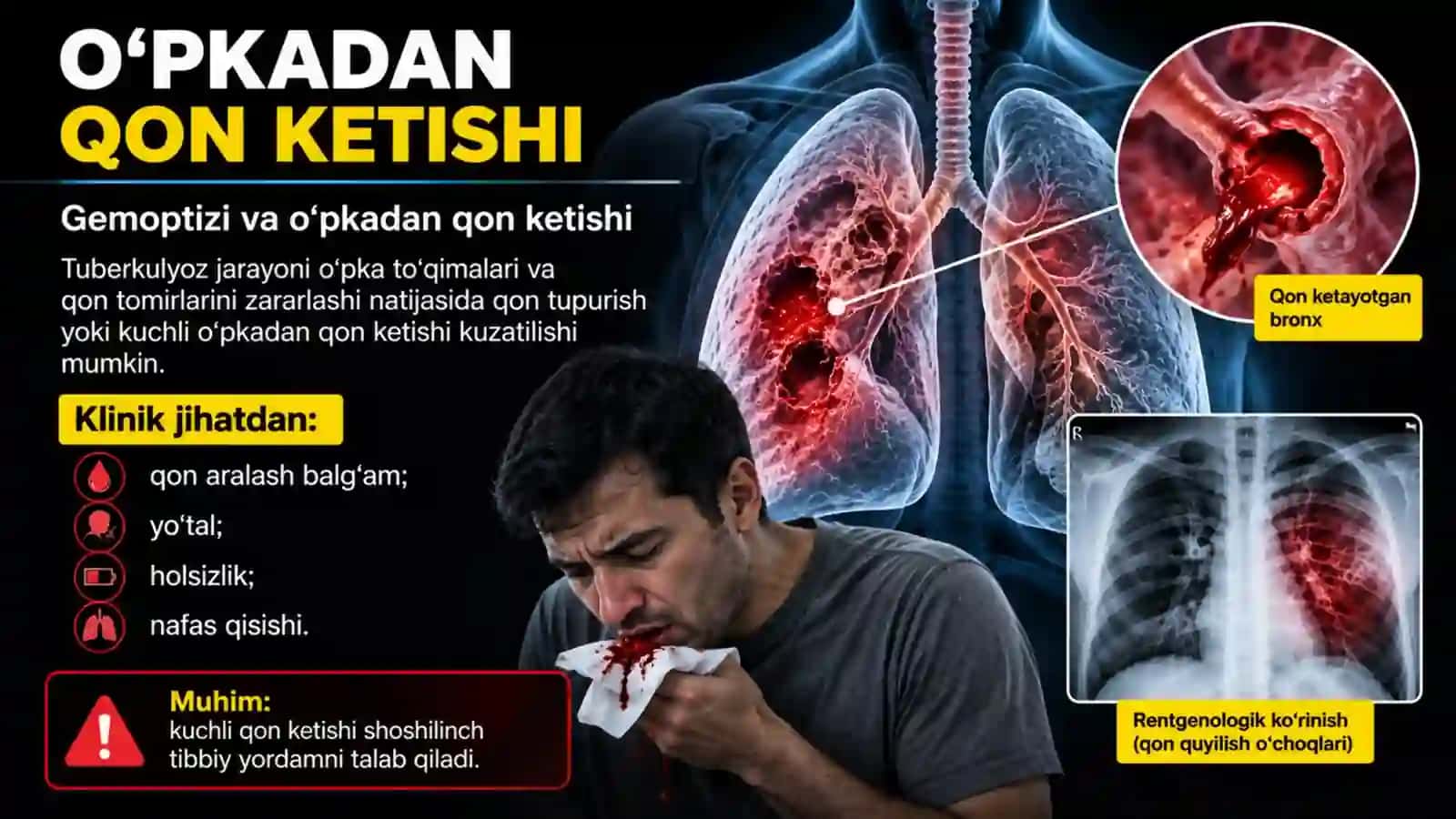Oʻpka tuberkulyozi asoratlari. Tuberkulyoz bilan kasallangan bemorlarda nafas yetishmovchiligi.pptx 4
