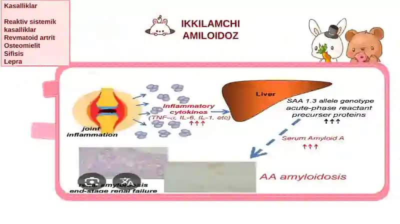 MAMILOIDOZ 4