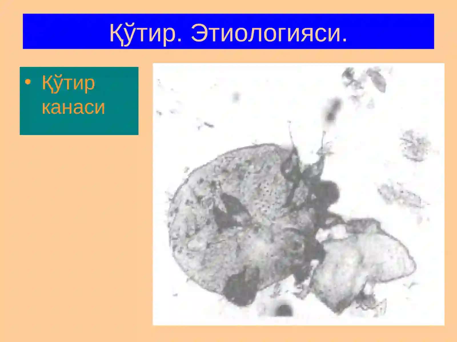 Терининг паразитар[qo'tir) касаллиги 4