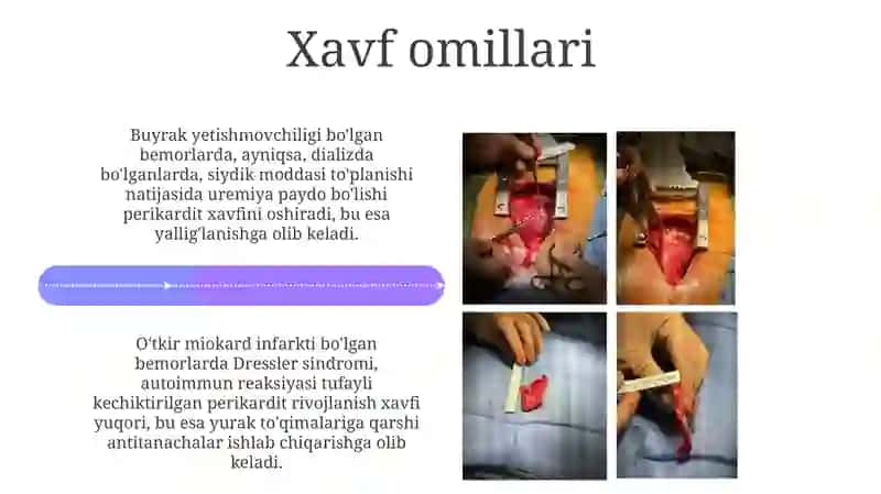 Perikarditlar 4