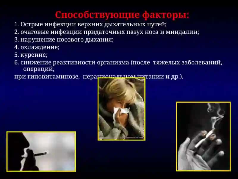 Острый бронхит 4