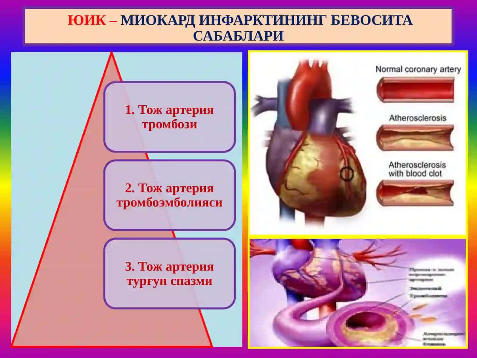 Юрак ишемик касаллиги. Цереброваскуляр касаллик 4