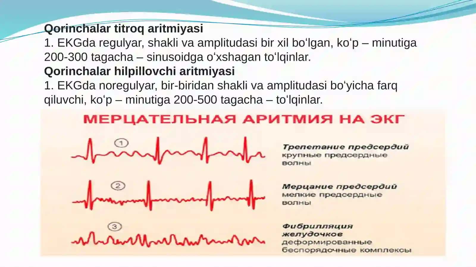 Aritmiyalarda EKG interpretatsiyasi 4