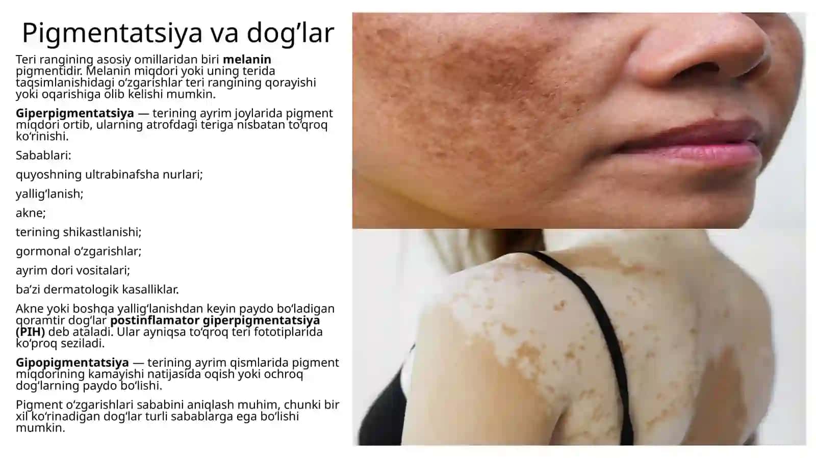 Kosmetik terining nuqsonlarini diagnostika qilish 4