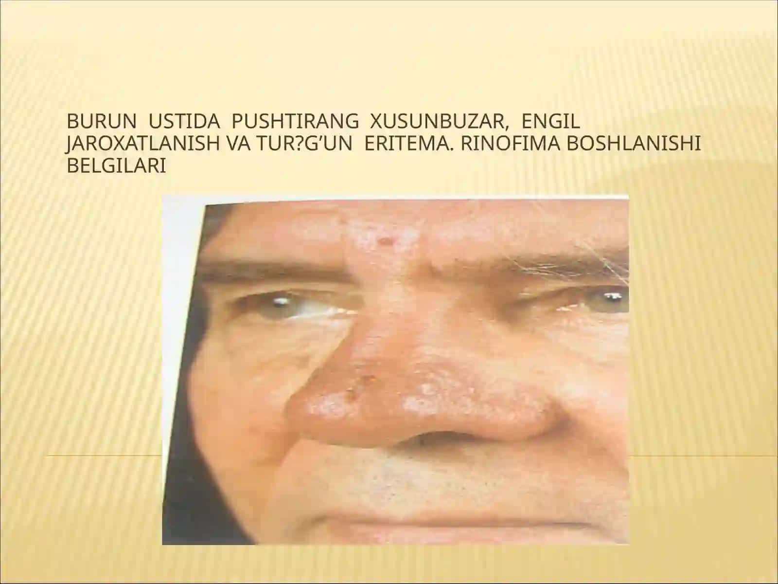 XUSUNBUZARLAR (UGRI) 4