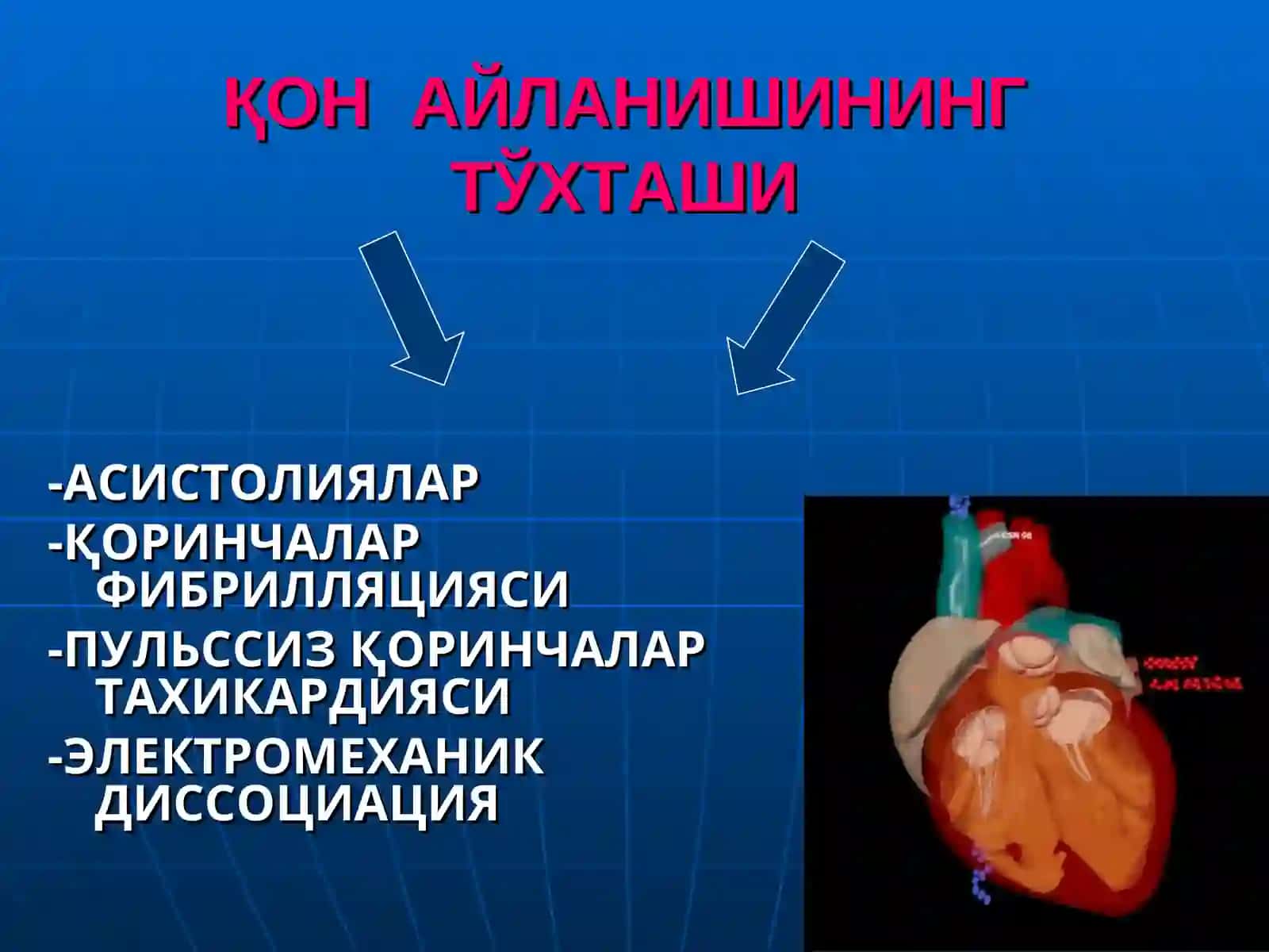 ЮРАК- ЎПКА РЕАНИМАЦИЯСИНИ ЎТКАЗИШ 4