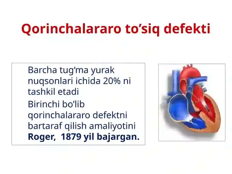 Tug'ma yurak nuqsonlari 4