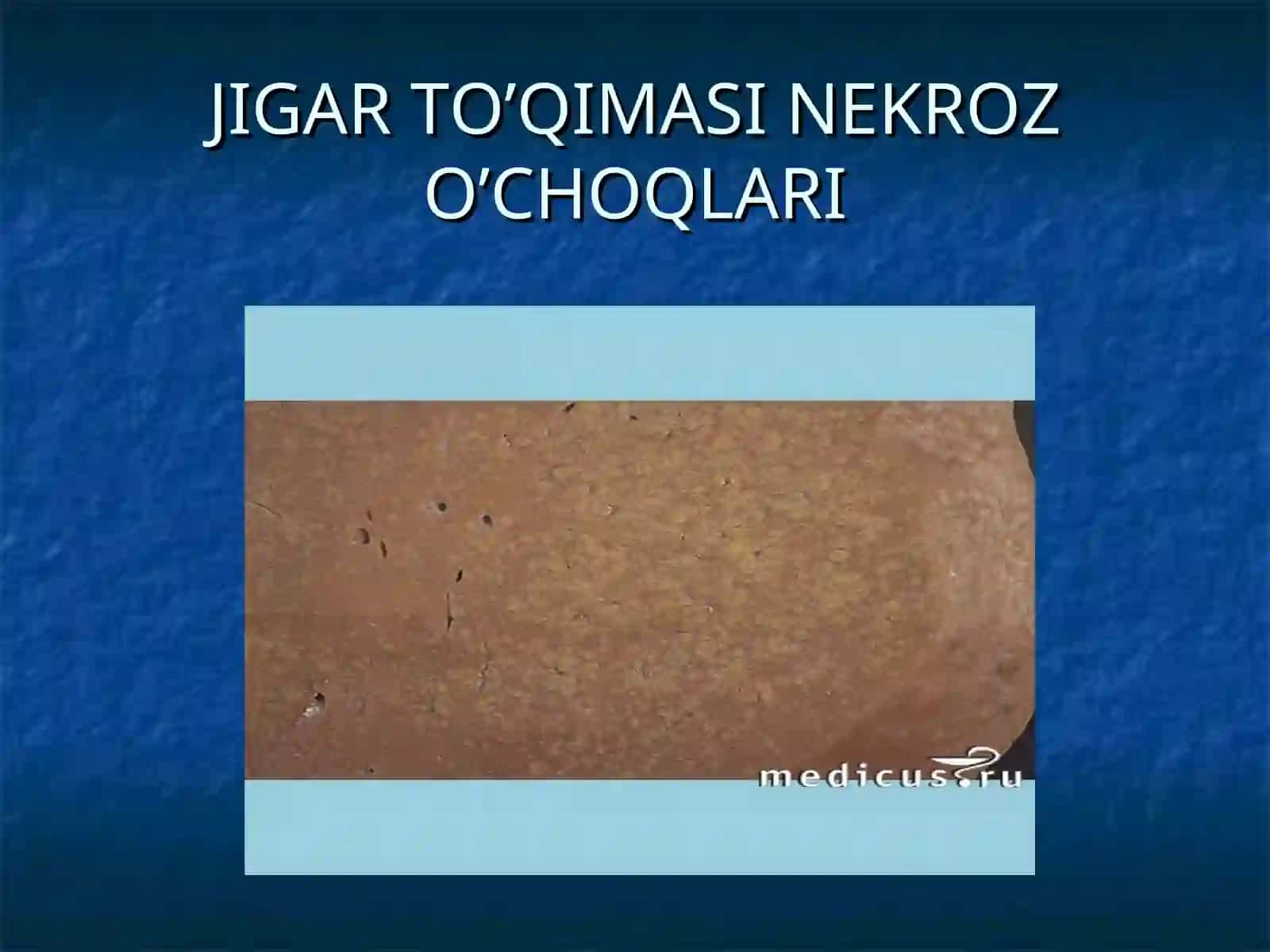 JIGAR SIRROZI 4