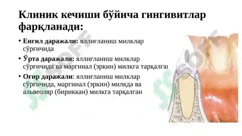 Гингивитлар 5