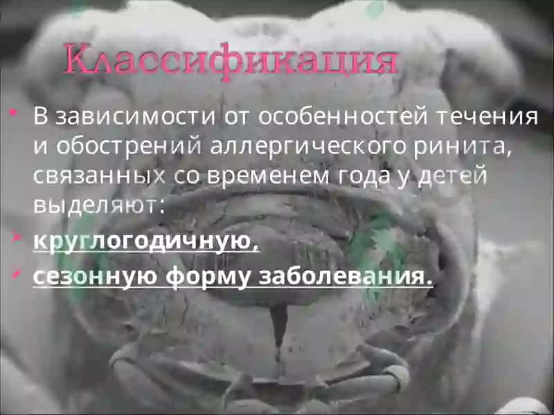 Аллергический ринит 5