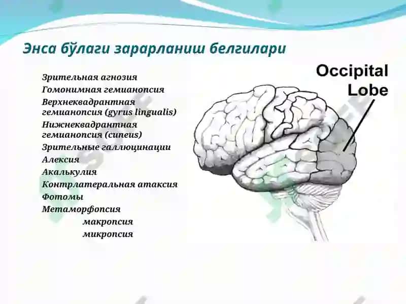Бош мия ўsmалари 5