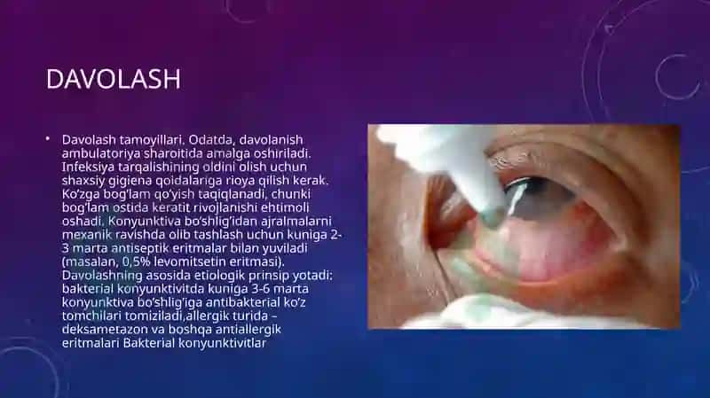 Kon’yunktivitlarnibirdanepidemikavjolishinioldiniolishbo`yichaprofilaktikchoratadbirlar 5