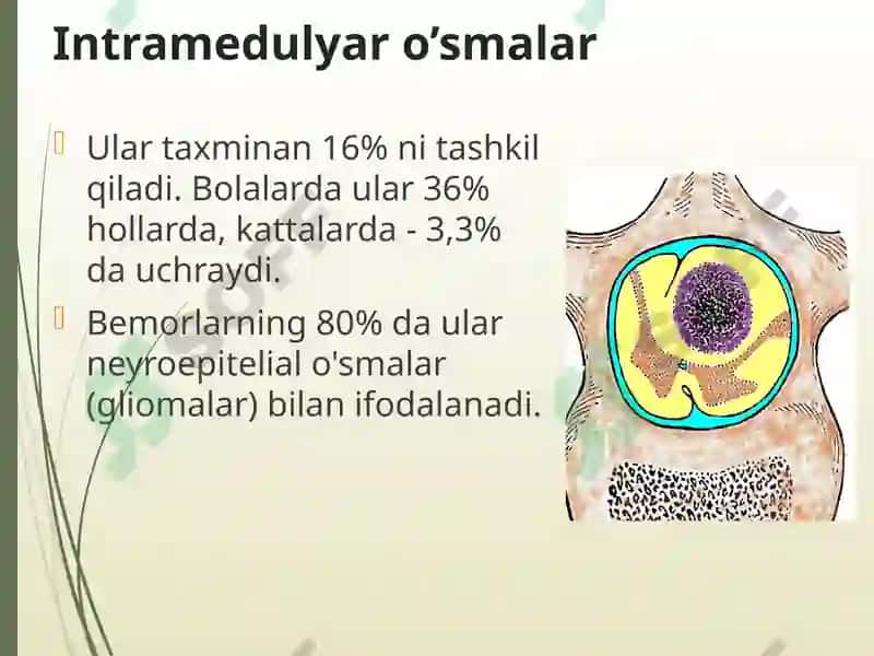 Orqa miya o’smalari 5