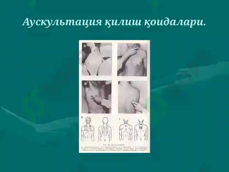 Ўпка аускультацияси 5