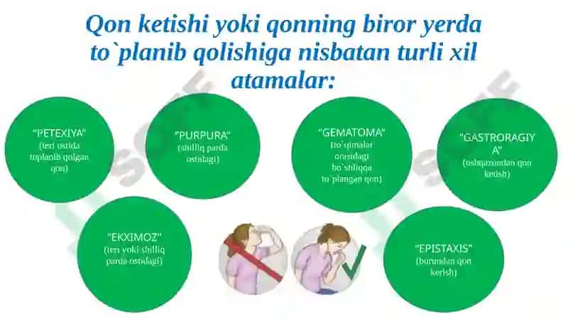 Qonketishturlari 5