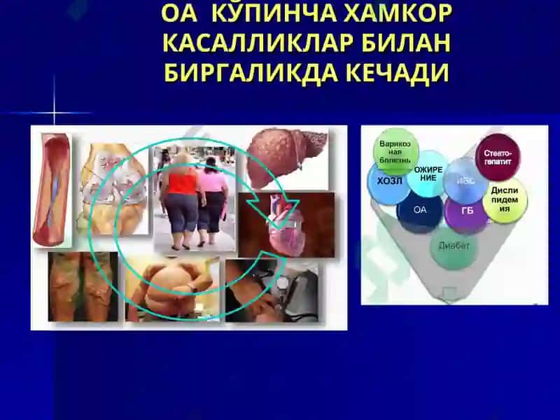 Буғим синдромини таққослама ташхиси ва умумий амалиёт шифокори тактикаси 5