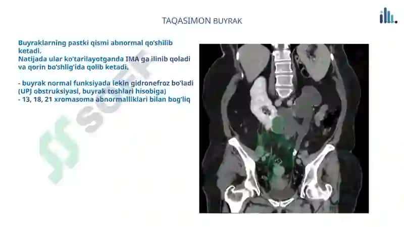 Renal Panalogiya 6
