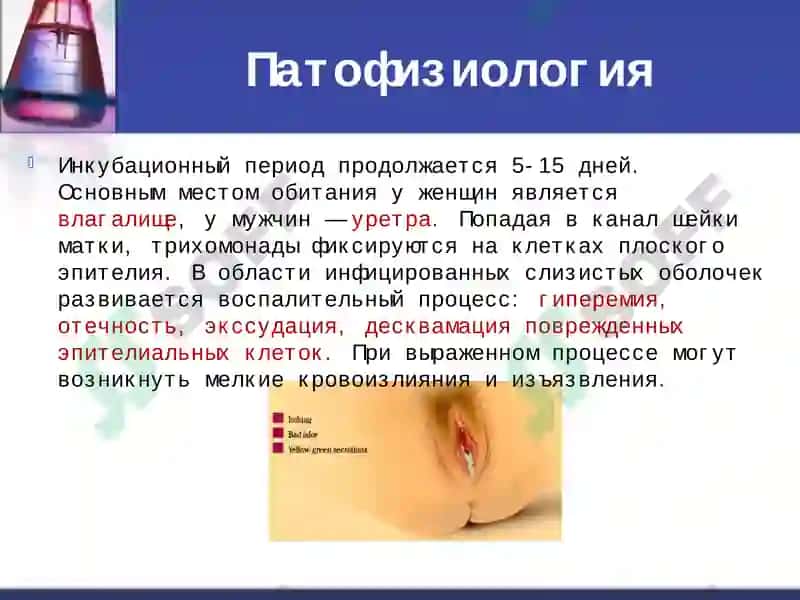 Трихомониаз 6