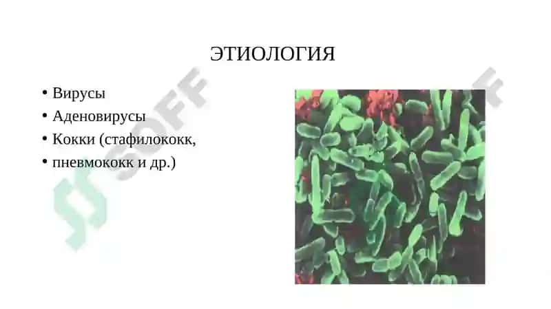 Острые и хронические заболевания носа и его придаточных пазух 6