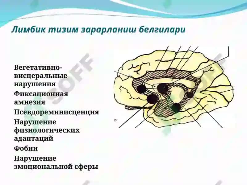 Бош мия ўsmалари 6