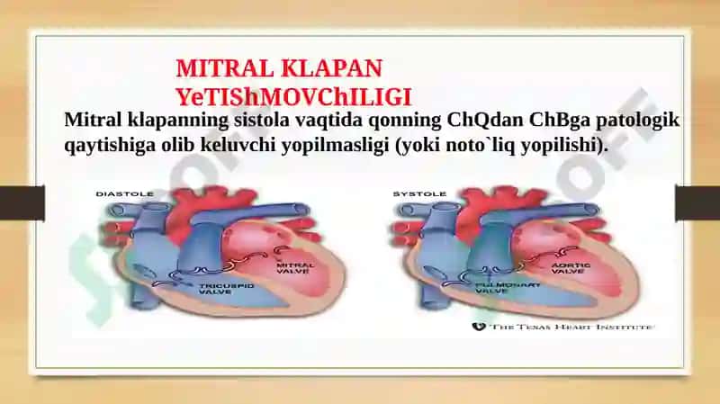 Mitral klapan nuqsonlari 6