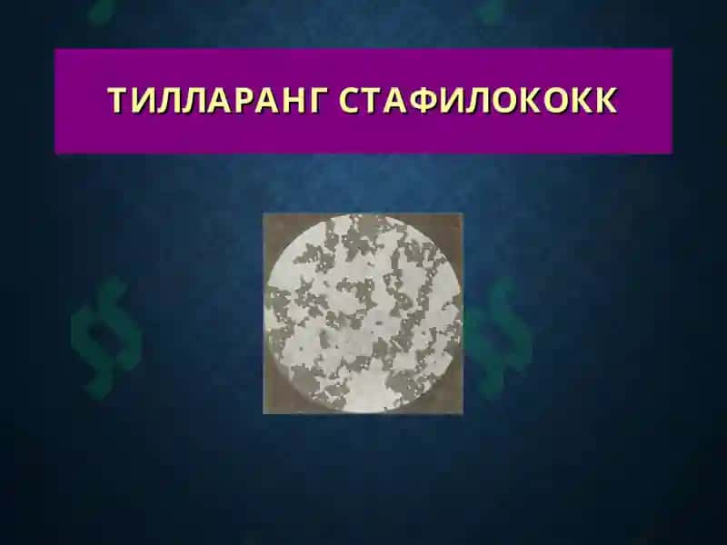 Терининг йирингли касалликлари 6