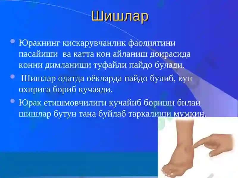 Юрак етишмовчилиги ва уни даволаш(Артмия сидроми) 7