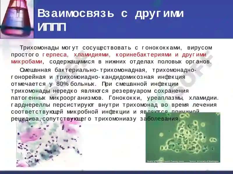 Трихомониаз 7