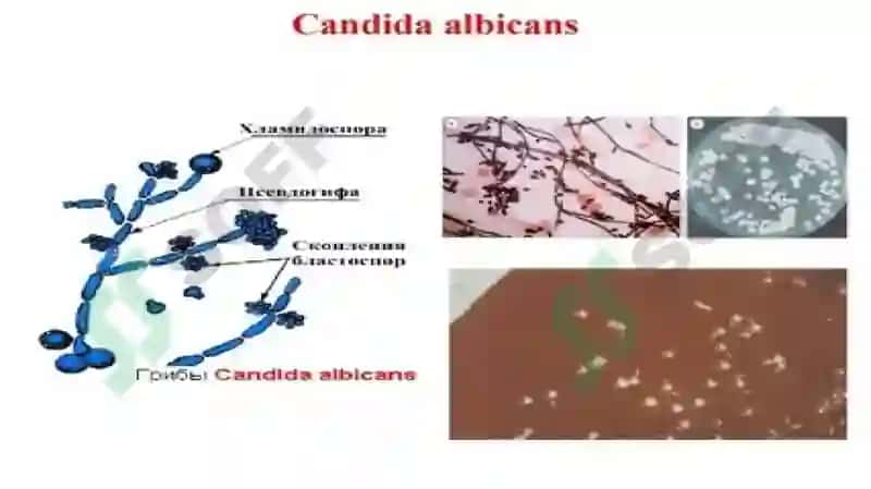 Imunitet tizimi faoliyati bilan zamburug'li va parazitar kasalliklar kelib chiqishidagi bog'liqliklar 7