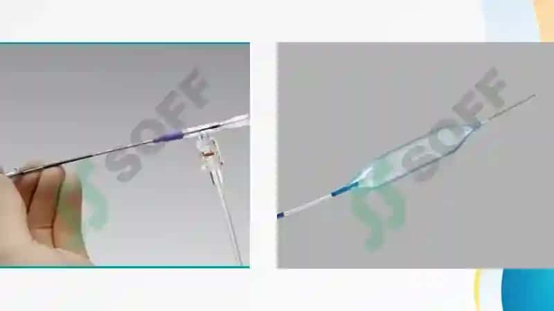 Ballonosinusoplastika 7