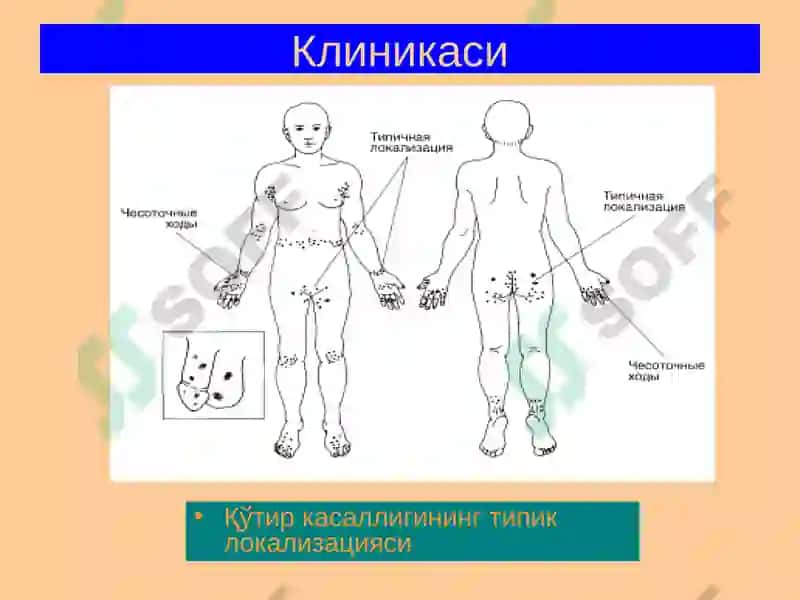 Терининг Паразитар Касалликлари 7