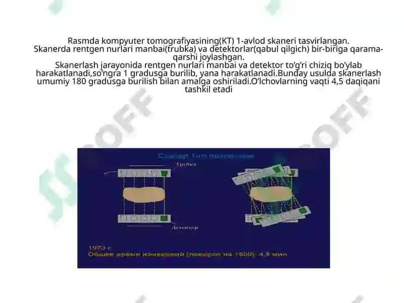 Kompyuter tomografiyasi 7