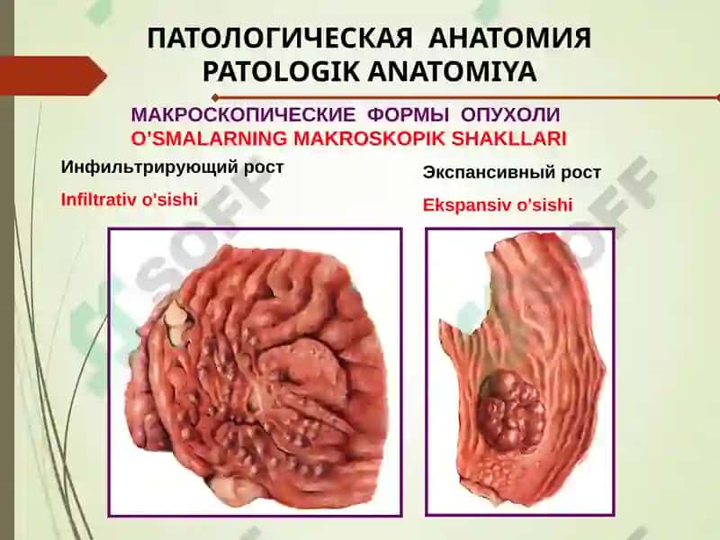 ОСНОВЫ ОНКОЛОГИИONKOLOGIYA ASOSLARI 7
