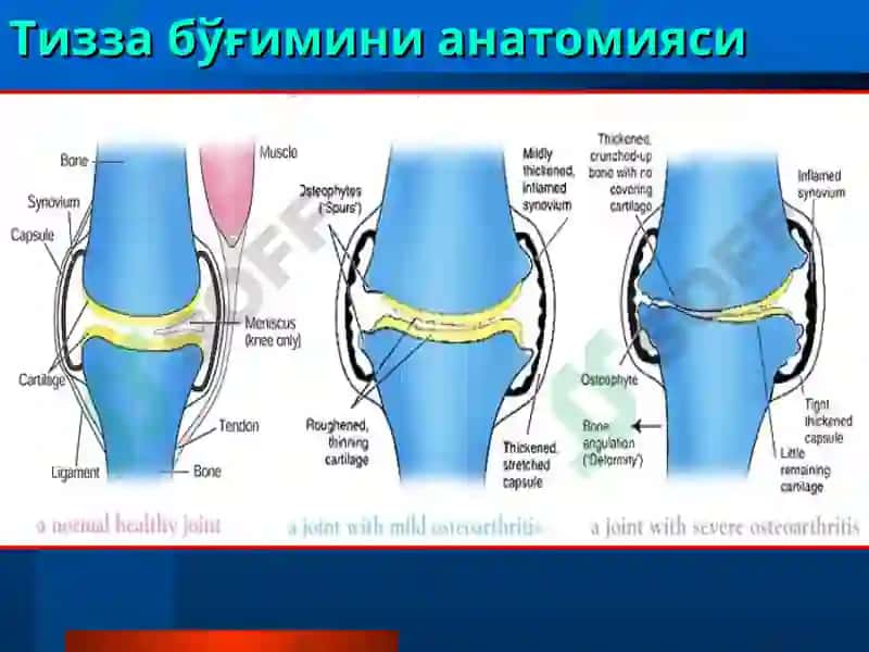 ТОШКЕНТ ТИББИЁТАКАДЕМИЯСИ ТРАВМАТОЛОГИЯ, ОРТОПЕДИЯ ВА ХДЖ КАФЕДРАСИ ЛЕКЦИЯ 7