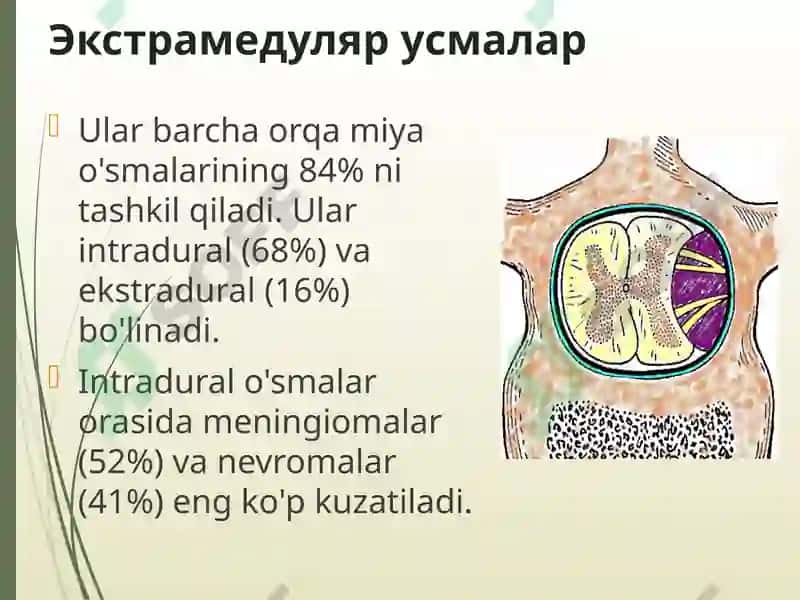 Orqa miya o’smalari 7