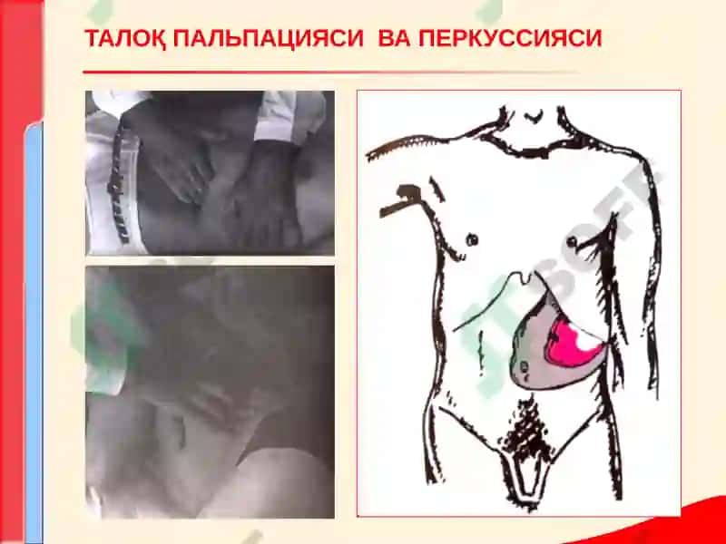 КОН ТИЗИМИ КАСАЛЛИКЛАРИ БИЛАН КАСАЛЛАНГАН БЕМОРЛАРНИ ТЕКШИРИШ 7
