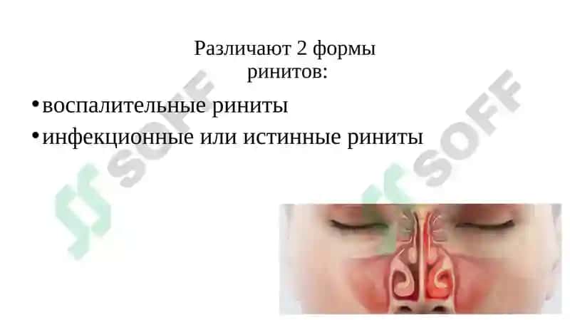 Острые и хронические заболевания носа и его придаточных пазух 7