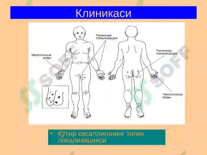 Терининг паразитар касалликлари 8
