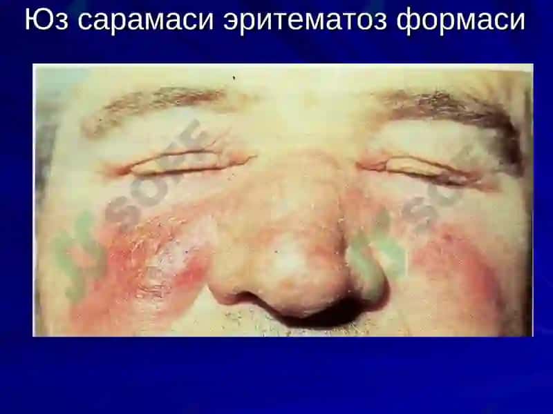 Сарамас 8
