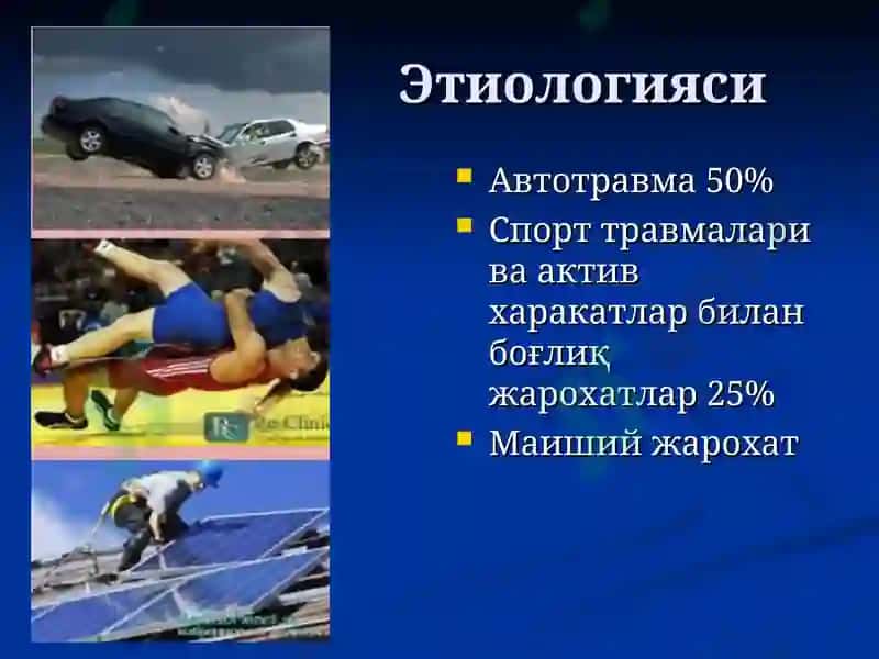 Умуртқа поғонаси ва чаноқ сохаси жароҳатлари 8