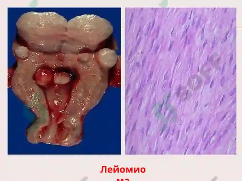 Опухоли 8