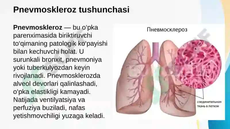 O’pkaning surunkali obstruktiv kasalliklari. Pnevmoskleroz. O’pka emfizemasi diagnostikasi (etiologiya, patogenez, klinika, tekshiruv uslublari, kechishi, davolash) 8
